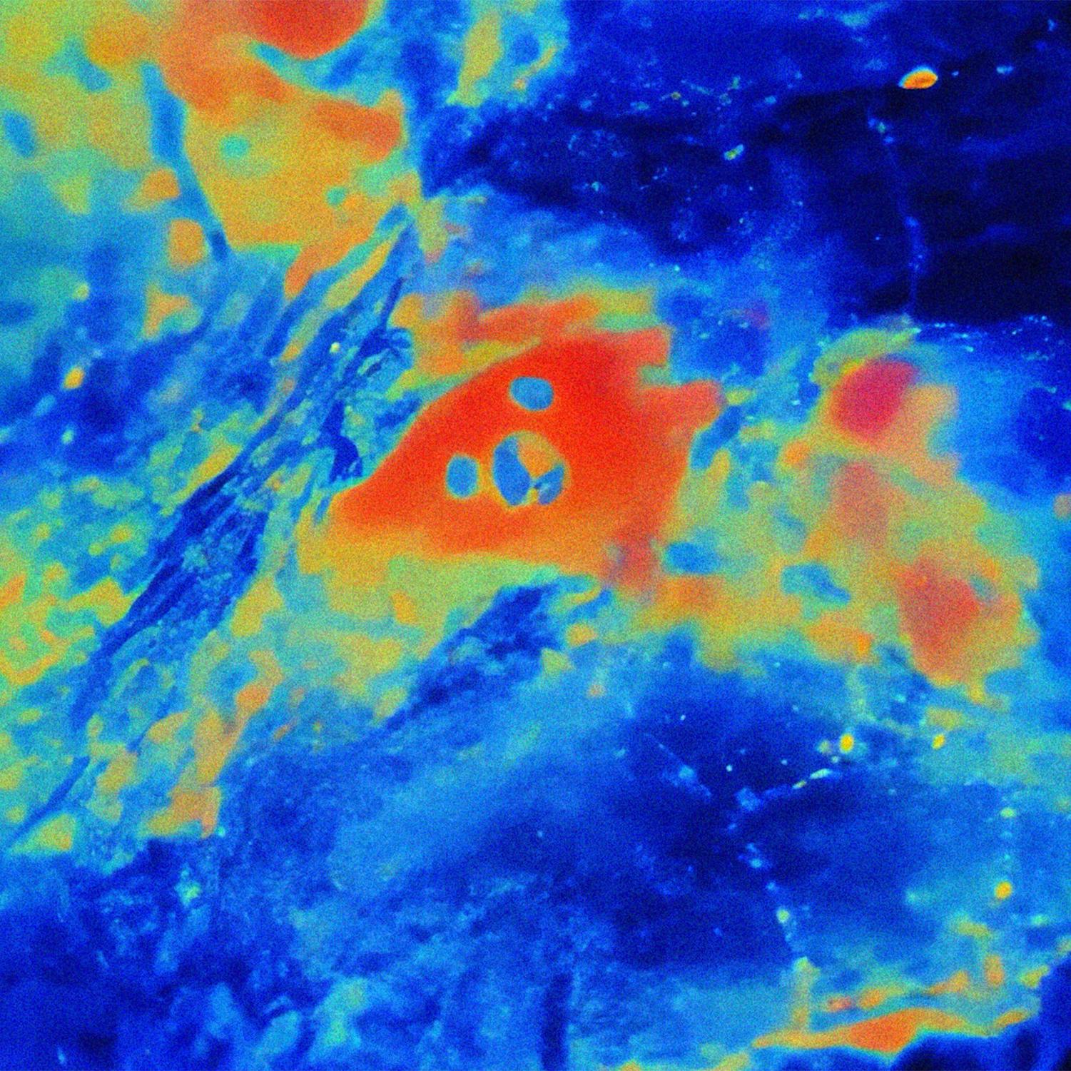 Thumbnail for "Astrocytes Might Be in Charge of the Brain". Thumbnail for "Astrocytes Might Be in Charge of the Brain".