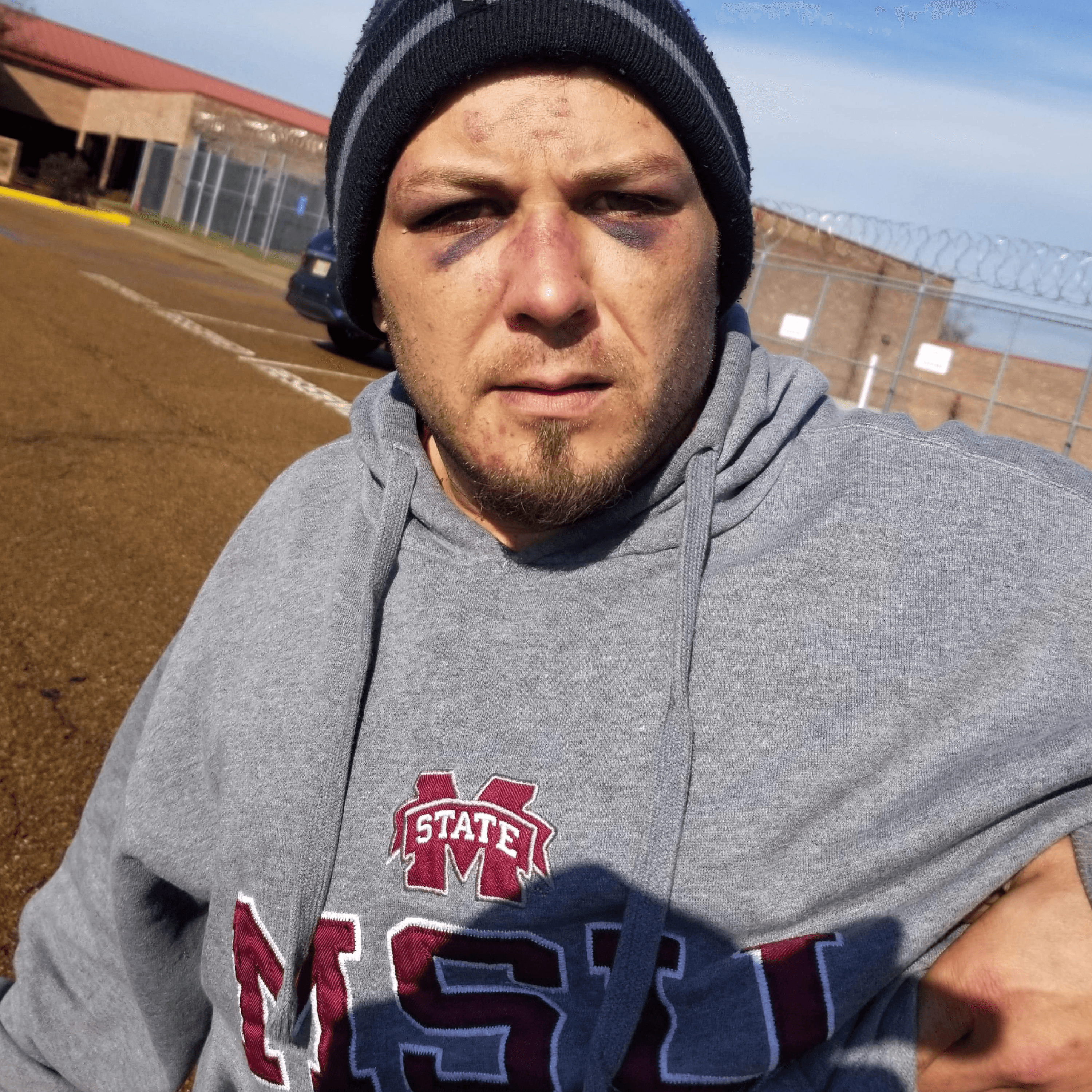 Thumbnail for "In a Mississippi Jail, Inmates Became Weapons". Thumbnail for "In a Mississippi Jail, Inmates Became Weapons".