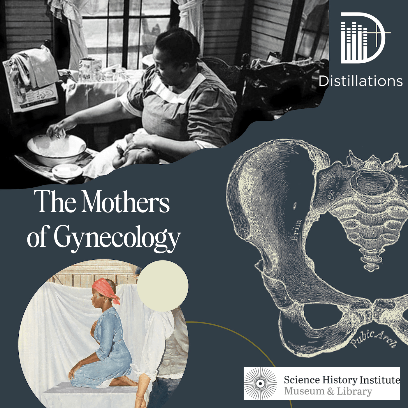 Thumbnail for "The Mothers of Gynecology". Thumbnail for "The Mothers of Gynecology".