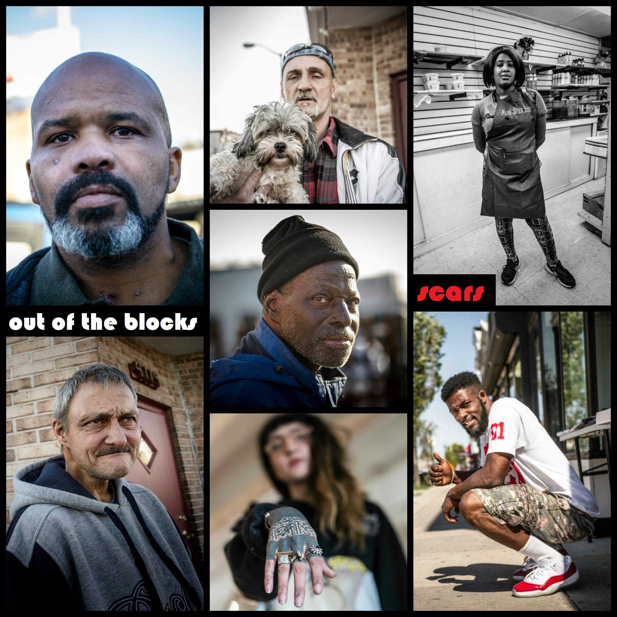 Thumbnail for "Scars". Thumbnail for "Scars".